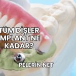 Tüm Dişler İmplant Ne Kadar?