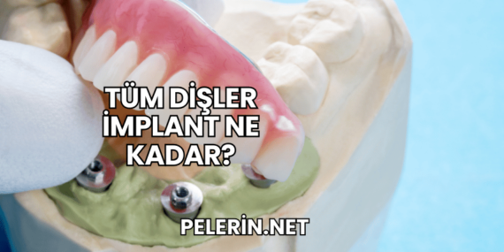 Tüm Dişler İmplant Ne Kadar?