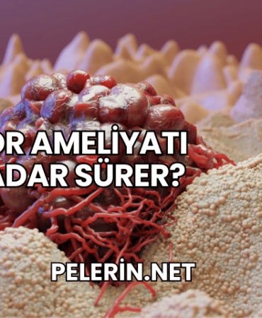 Tümör Ameliyatı Ne Kadar Sürer?