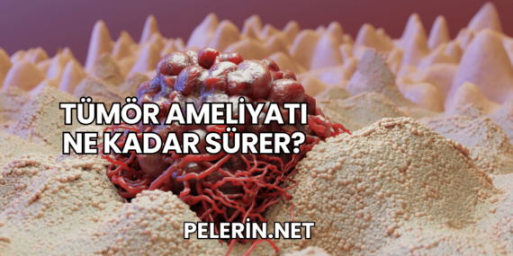 Tümör Ameliyatı Ne Kadar Sürer?